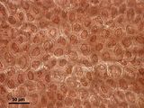 4 - Cellule corticali in visione superficiale